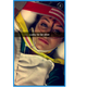 McGee took a Snap after the accident showing her injury. Photo: The Law Offices of Michael Lawson Neff